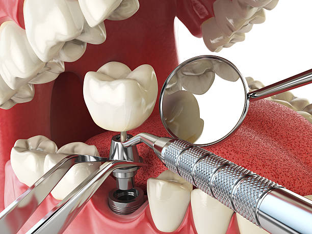 Best Emergency Dental Care for Trauma or Injury in Glen Ridge, NJ